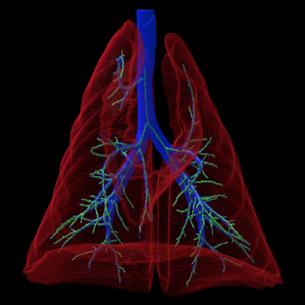Global, regional and local recruitment of the lungs taking into account the deformation.